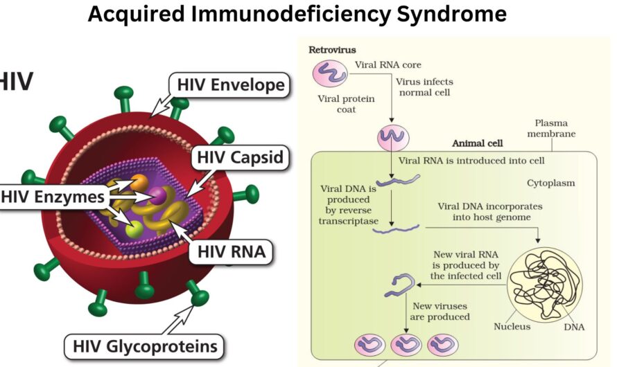 AIDS | HIV and AIDS | HIV Basics | CDC