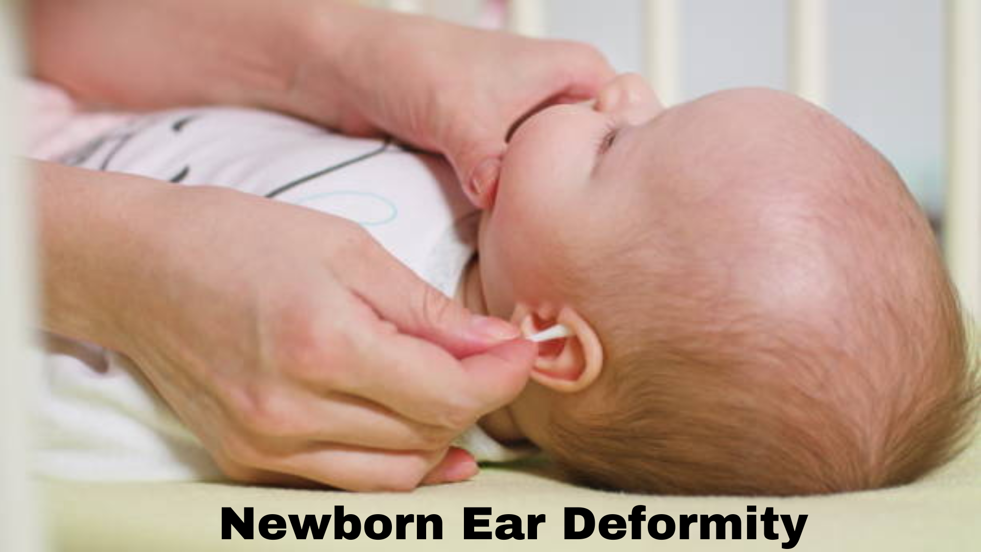 Newborn Ear Deformity