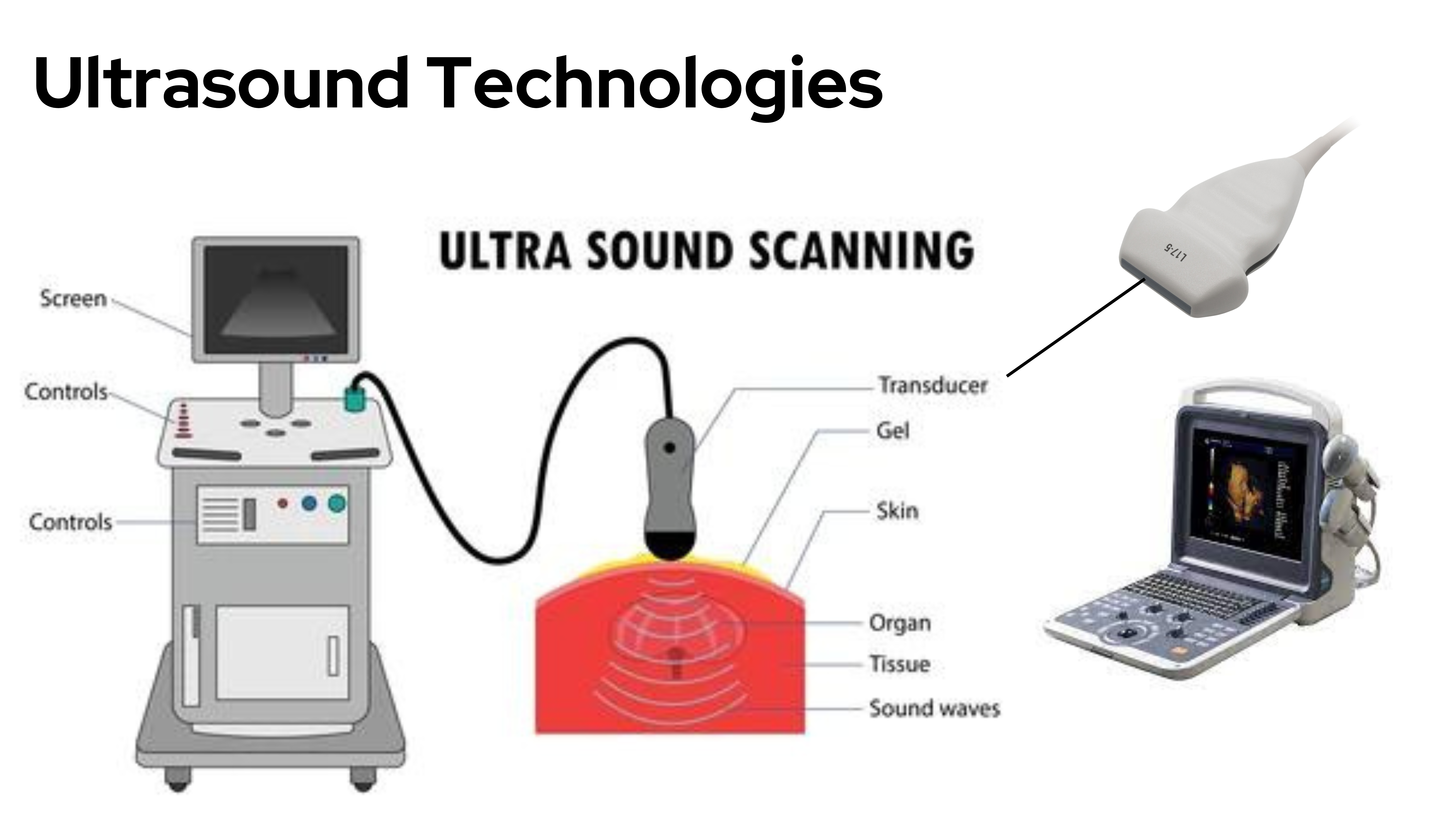 Ultrasound Technology