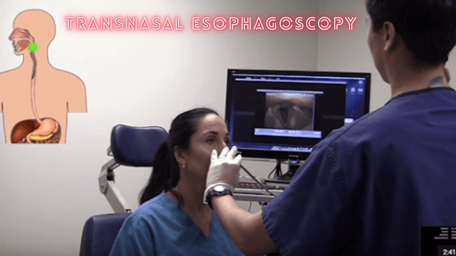 Transnasal Esophagoscopy