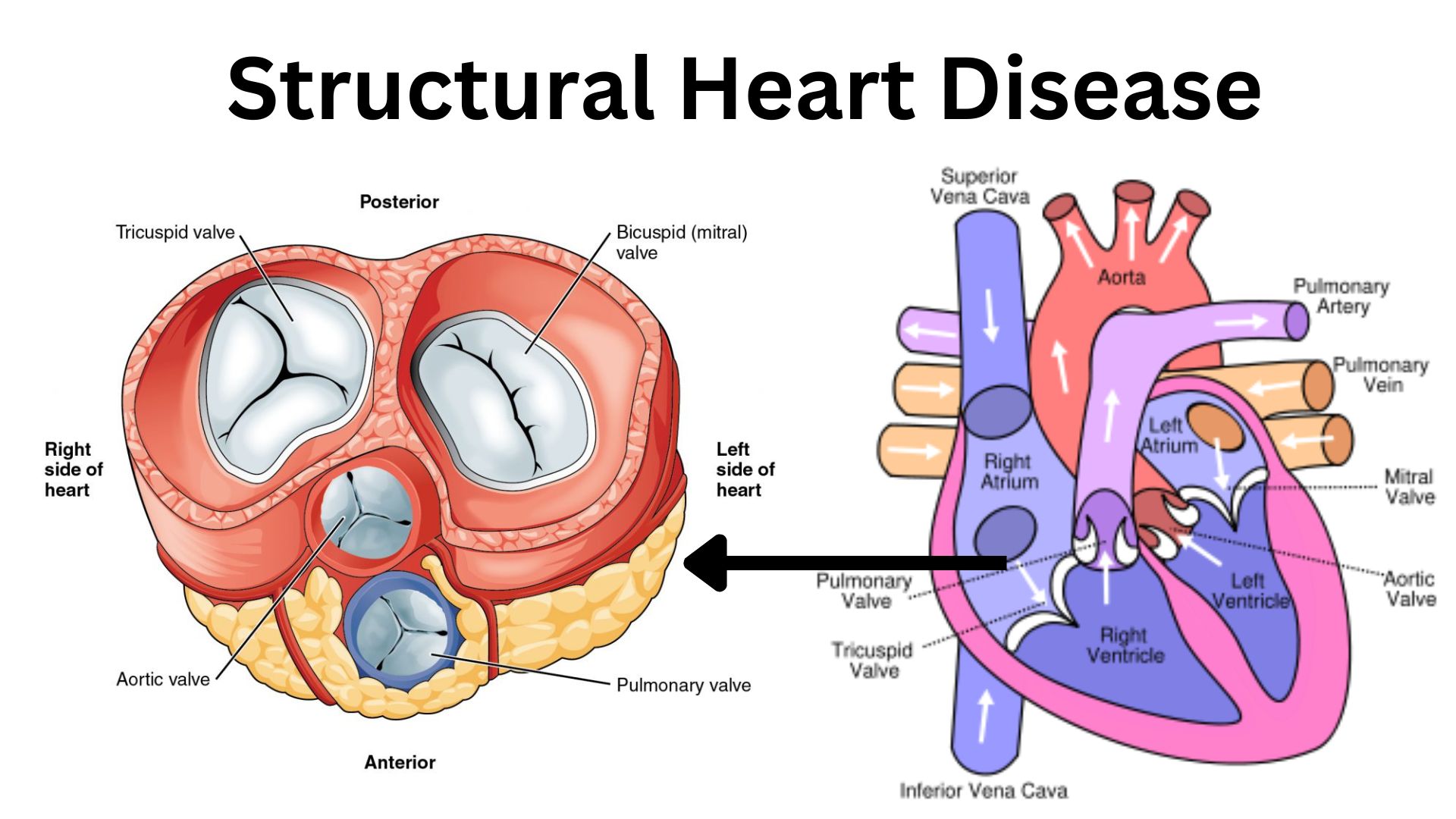 Structural Heart Disease