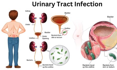 UTI Treatments Over the Counter