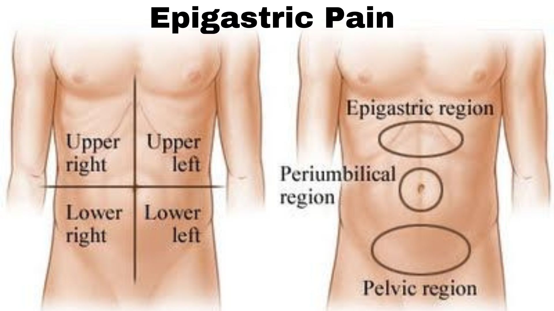 Epigastric Pain ICD 10