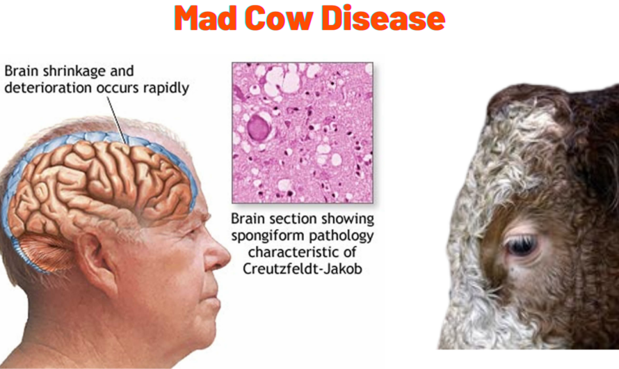 Mad Cow Disease SC: Critical Insights into Prevention and Safety in 2024
