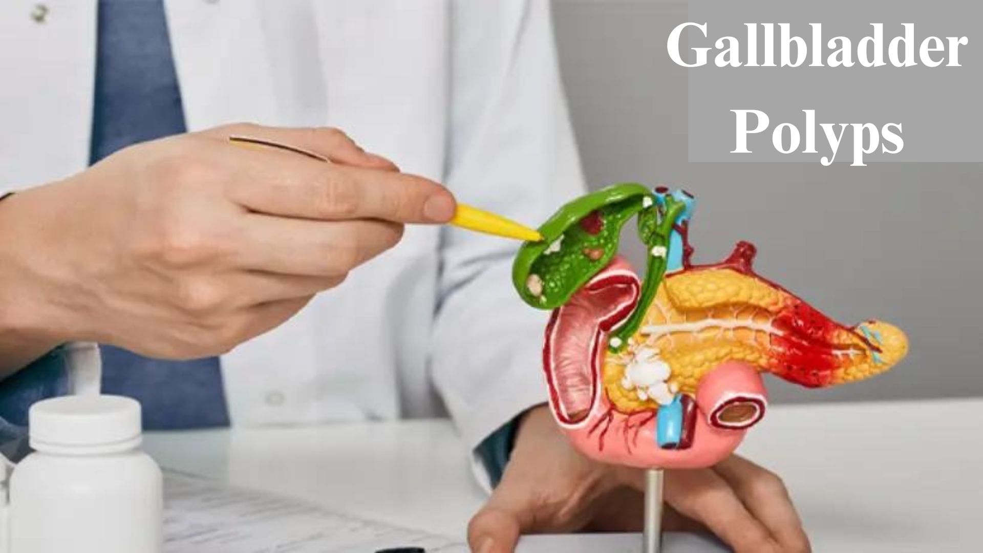 Gallbladder Polyps ICD 10
