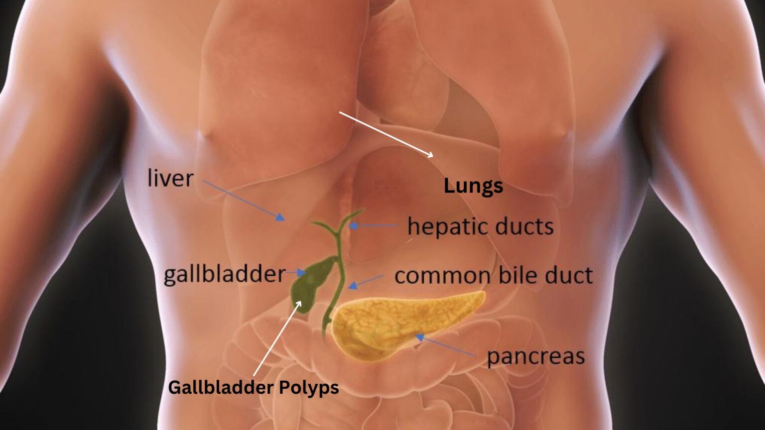 history of gallbladder cancer icd-10