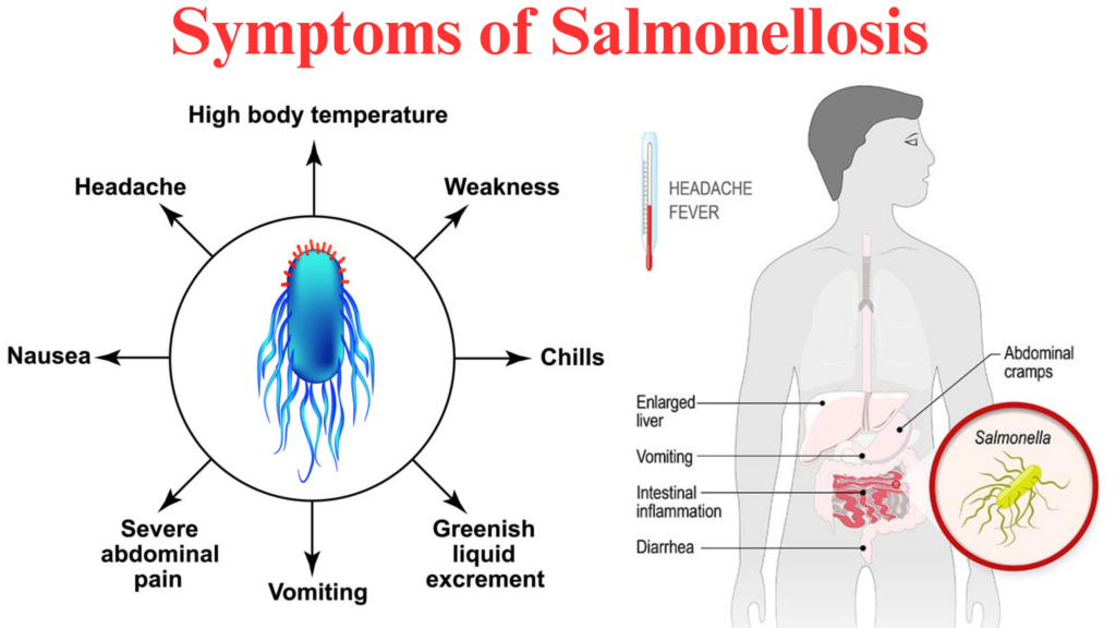 Salmonellosis Pronunciation